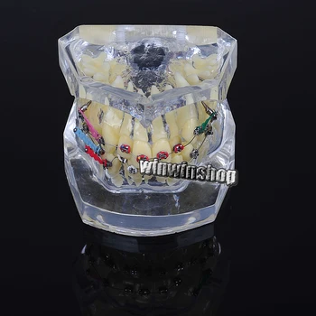 1 adet Diş Ortodontik Çalışma Metal Parantez ile Brace Diş Model Öğretmek