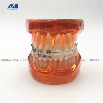 Metal İle 2016 yeni Yüksek kaliteli Ortodonti model ve seramik parantez Ortho Metal diş hekimi hasta öğrenci öğrenme modeli